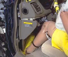 Footwell intrusion contributed to the possibility of injury to both legs