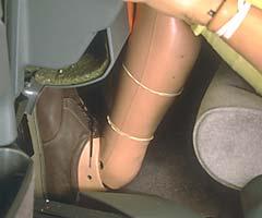 Moderate intrusion in the driver footwell area didn't cause high forces on the dummy's legs